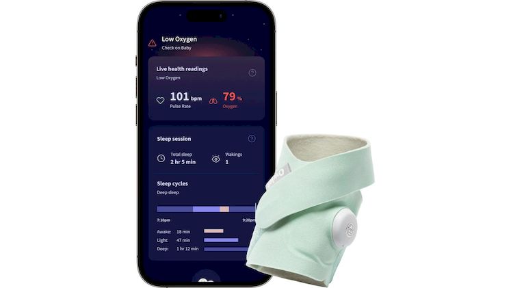 Owlet Dream Sock™ - Έξυπνη Kάλτσα Ελέγχου Βρεφικής Υγείας