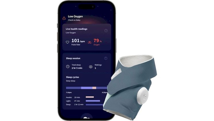 Owlet Dream Sock™ - Έξυπνη Kάλτσα Ελέγχου Βρεφικής Υγείας
